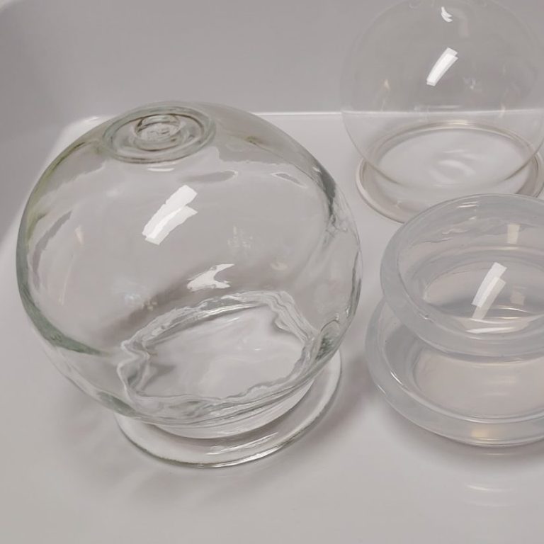 Bild KI Canva Schröpfgläser Praxis für Naturheilkunde Melanie Scheibe Heilpraktikerin